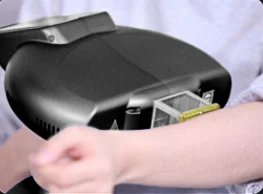 HOT SALE Vitiligo treatment 308nm portable light therapy machine 308nm