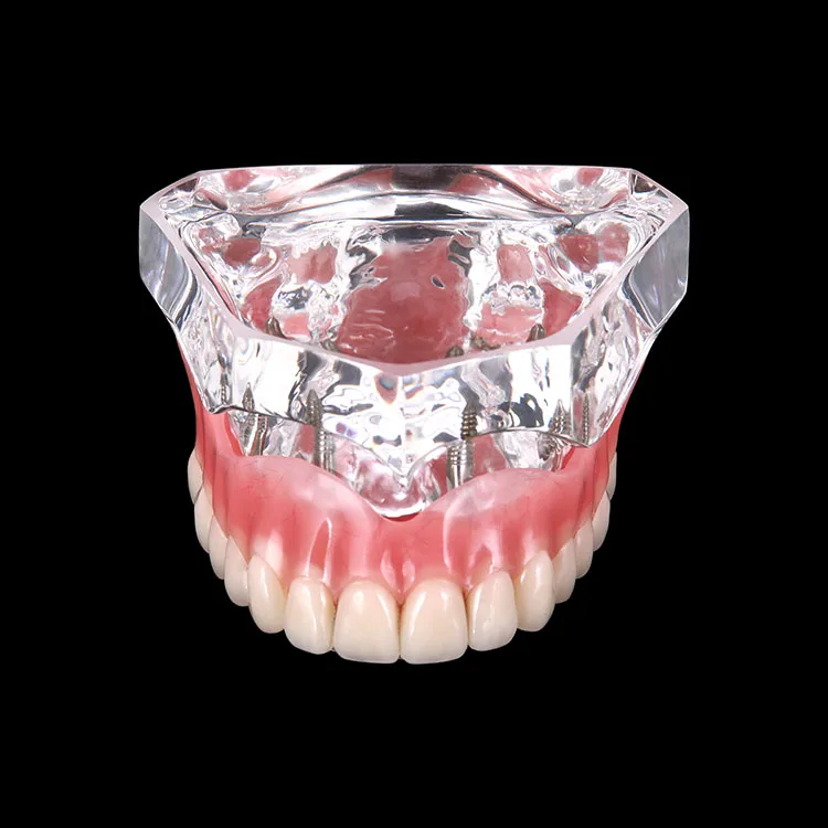 teeth model (2).jpg