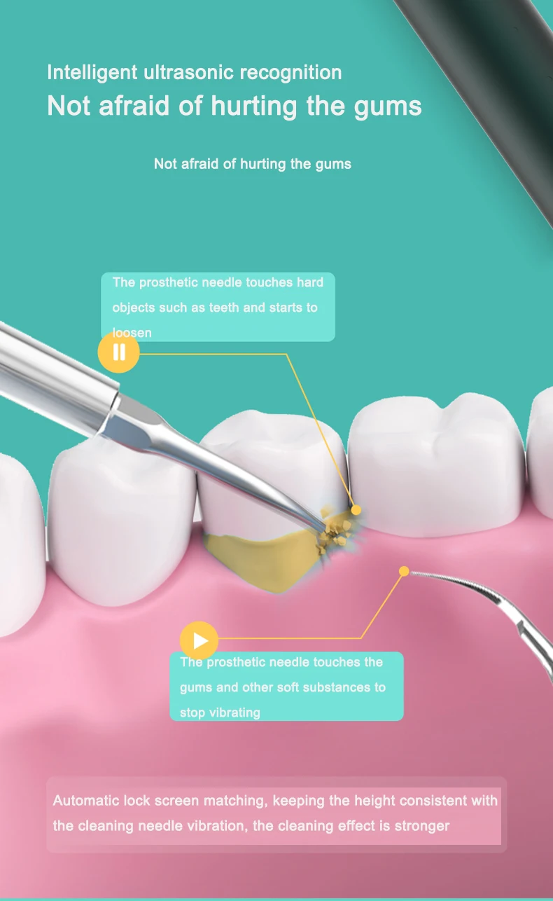2022 Hot Selling 3 Gear Dental Portable Electronic Ultrasonic Sonic Visual Teeth Whitening For Tartar Remover.jpg