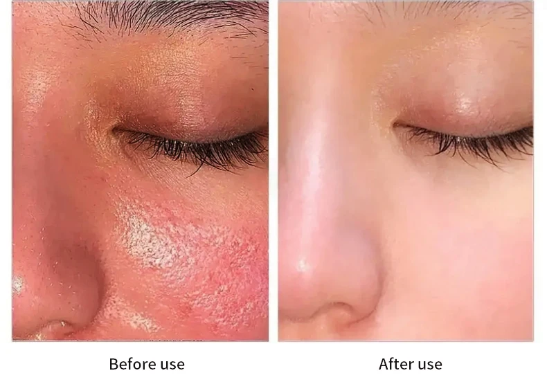 New Skin Care Serum Facial 5 in 1 Whitening Anti Age Snail Face Serum with 30% vitamin c 5% Niacinamide 10% Vitamin E Serum