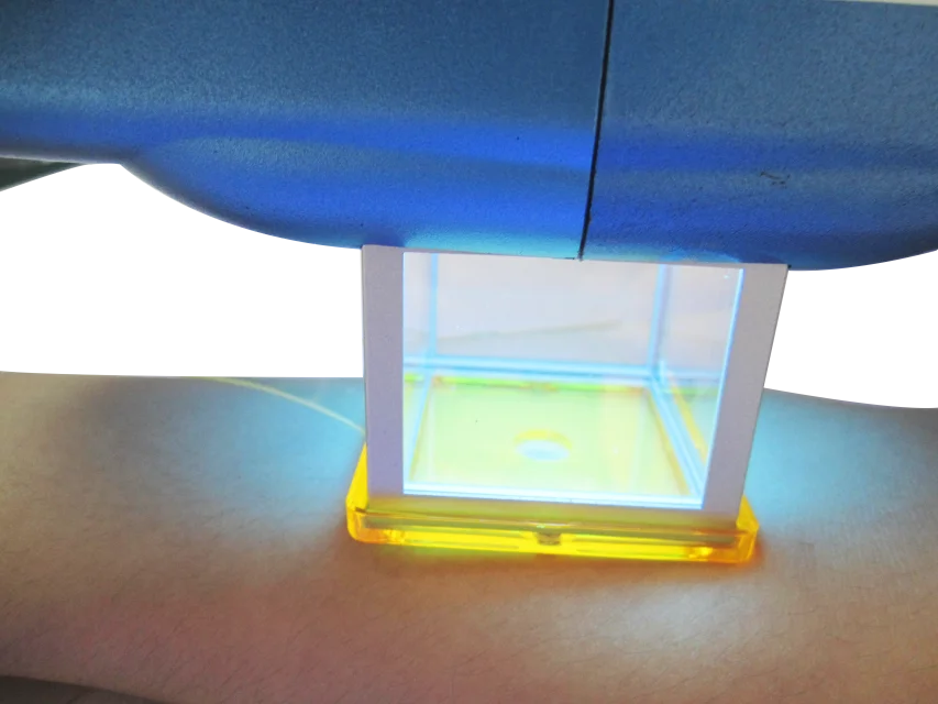 Портативный аппарат для лечения псориаза и витилиго для домашнего использования, 30 8нм