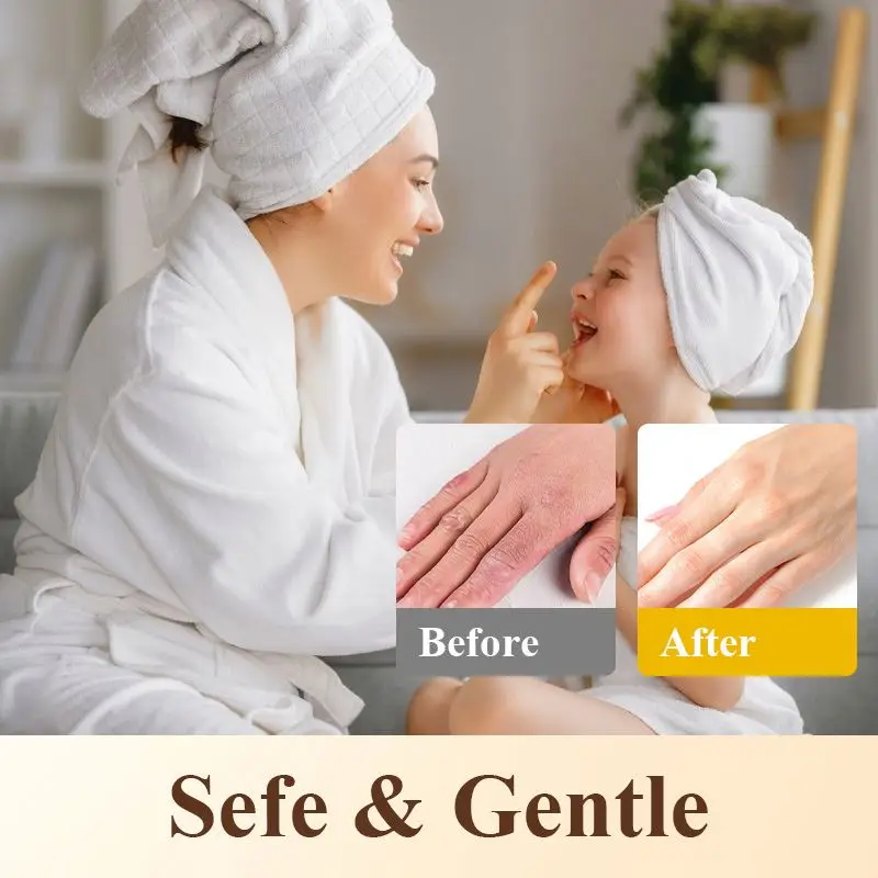 OEM/ODM Cream Body Salve Great for Eczema, Cracked, Dry, Itchy, Irritated Repair Skincare Tallow Balm