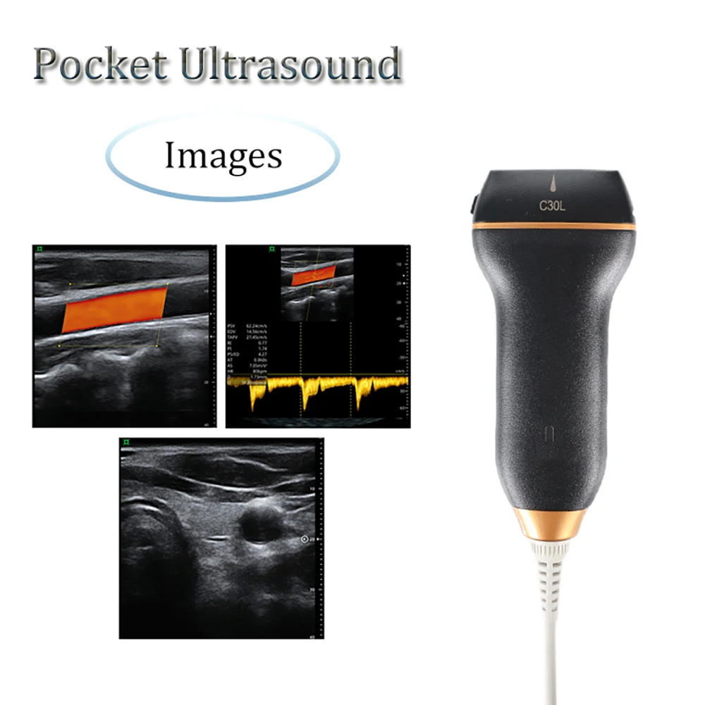 Ultrasonic Linear Probe Wireless Ultrasonic Handheld Ultrasound Scanner for use with mobile phones