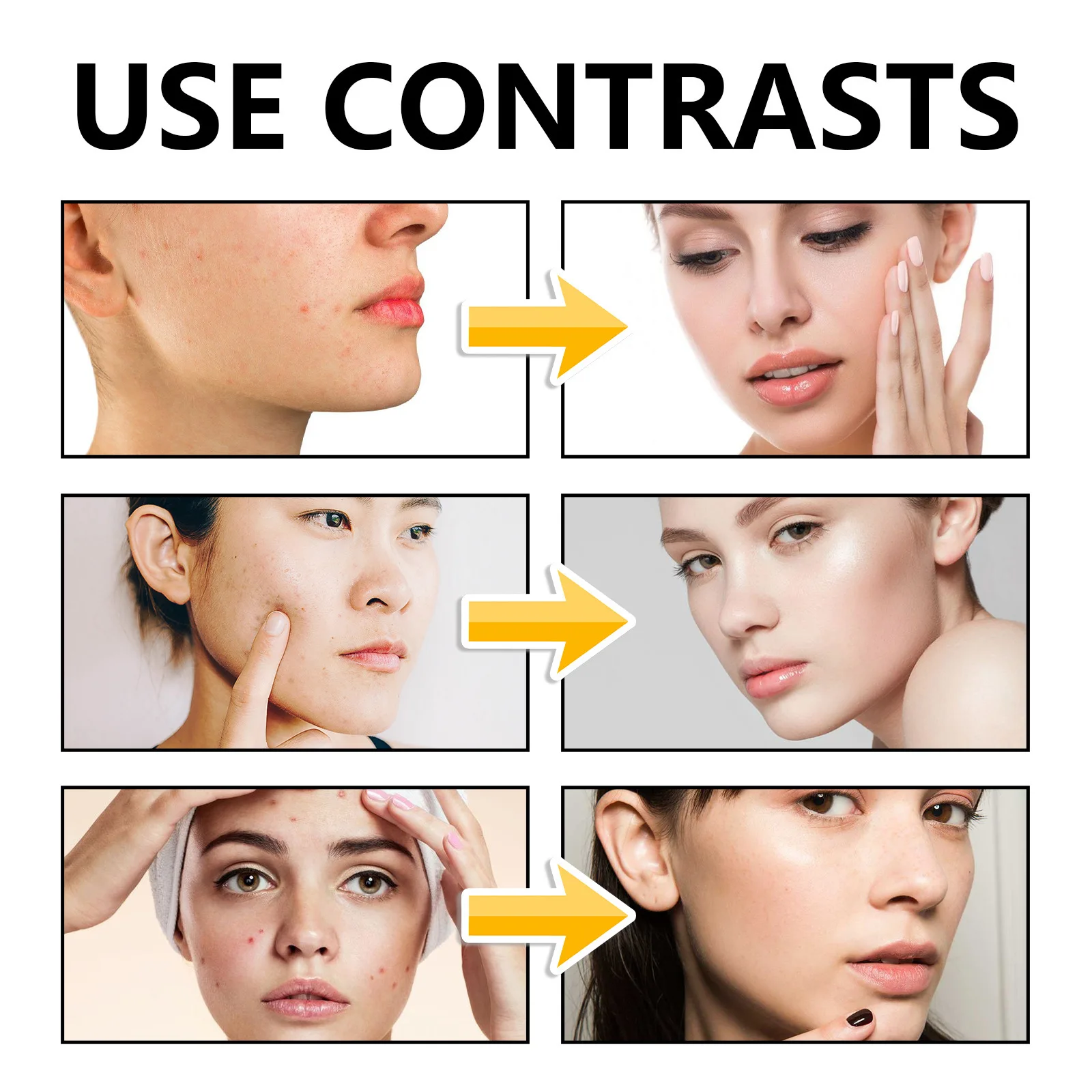 10% Sulfur Face Wash Facial Cleanser with Lemongrass Extract Seborrheic Dermatitis Breakouts Breakouts Relief for