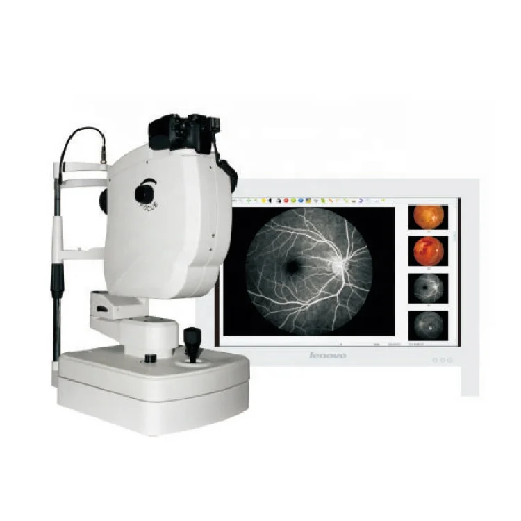 SK-650B Auto Digital Retinal Fundus Camera Ophthalmology