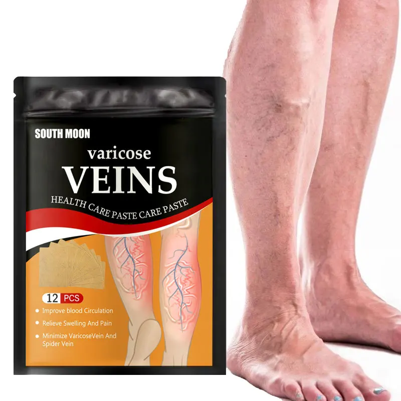 Wholesale Treating Varicose Veins Naturally Varicose Veins Care Removal Leg Plaster Treatment Varicose Vein Patch