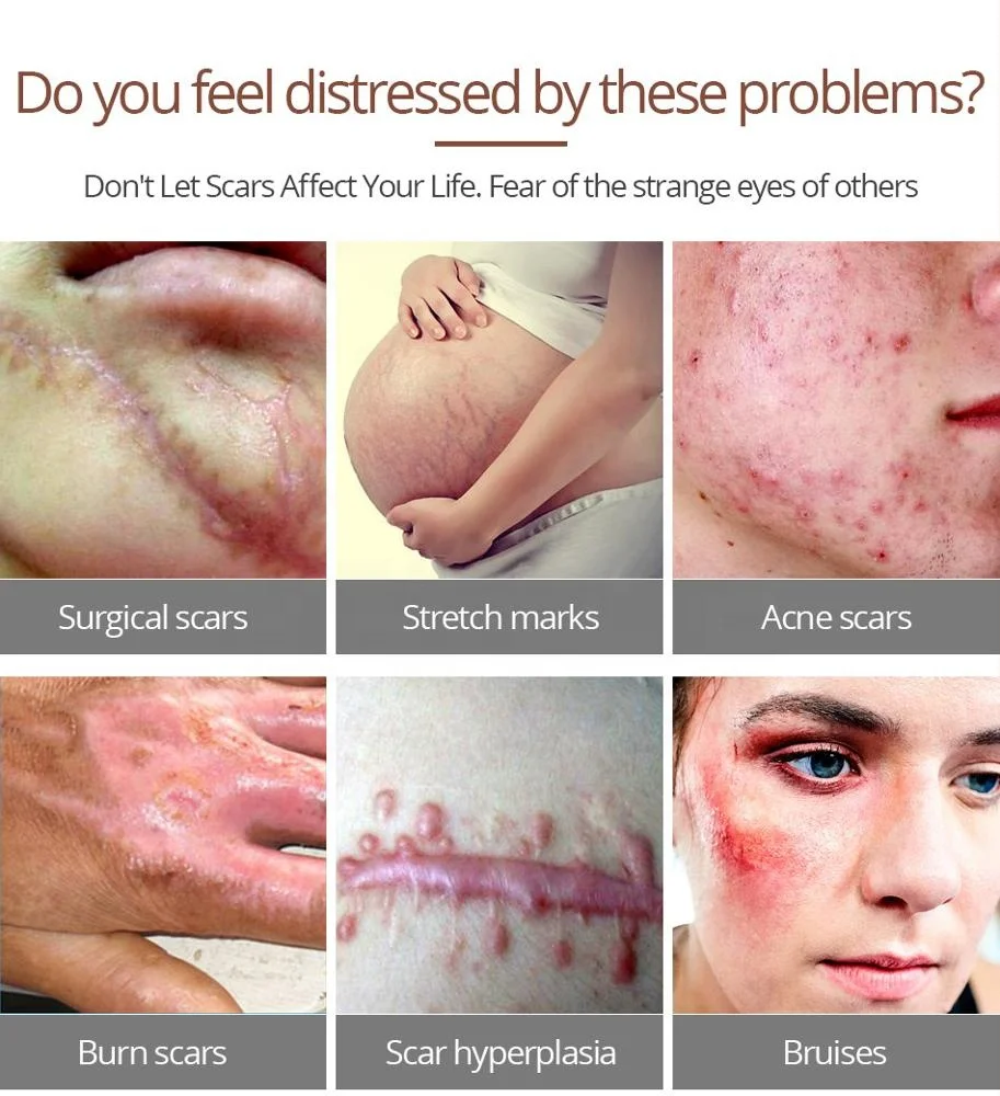 VIBRANT GLAMOUR Crocodile Repair Scar Anti -Wrinkle Moisturizing Whitening Shrink Pores Aging Face Cream