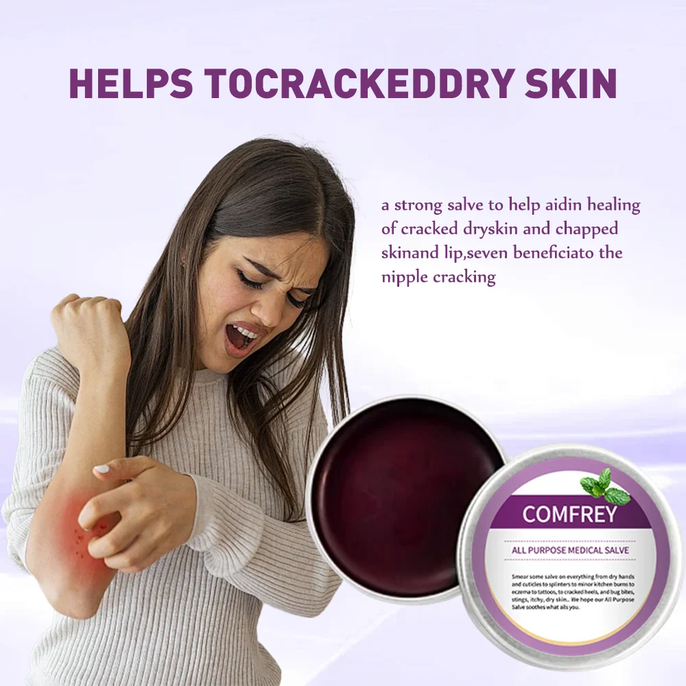 Natural Comfrey Ointment All Purpose Salve pain relief muscle aches sprain tension bruise cream burn care 30ml