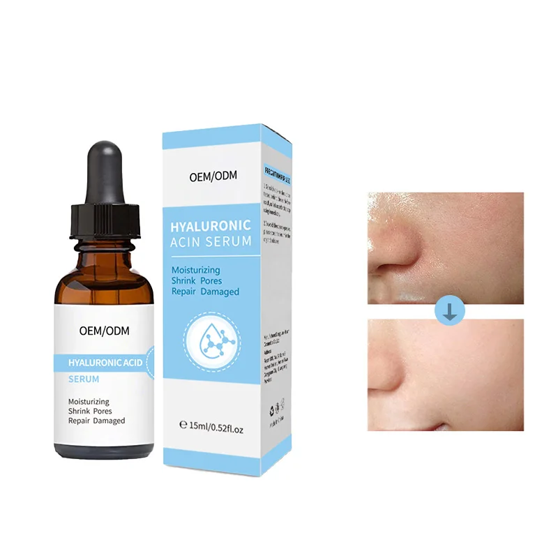 Private Label Moisturizing Shrink Pores Beta Glucan Hyaluronic Acid Serum For Face Collagen Facial Serum Skin Care