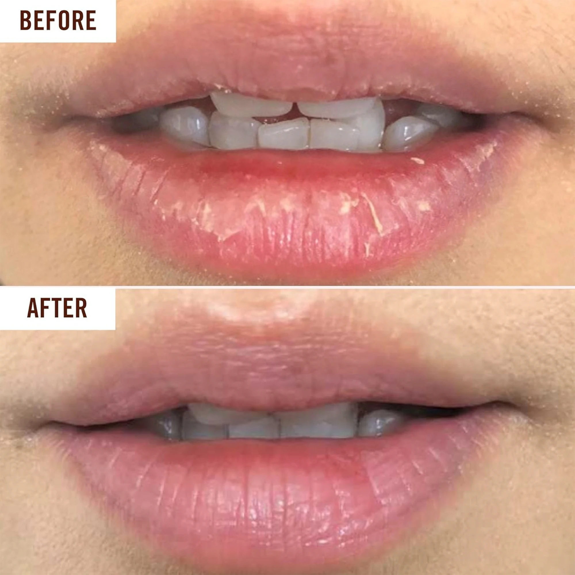Private Label Vegan SPF Hydrating Lip Treatment Moisturizer Natural Nourishing Grapeseed Oil Mint Shea Butter Clear Lip Balm