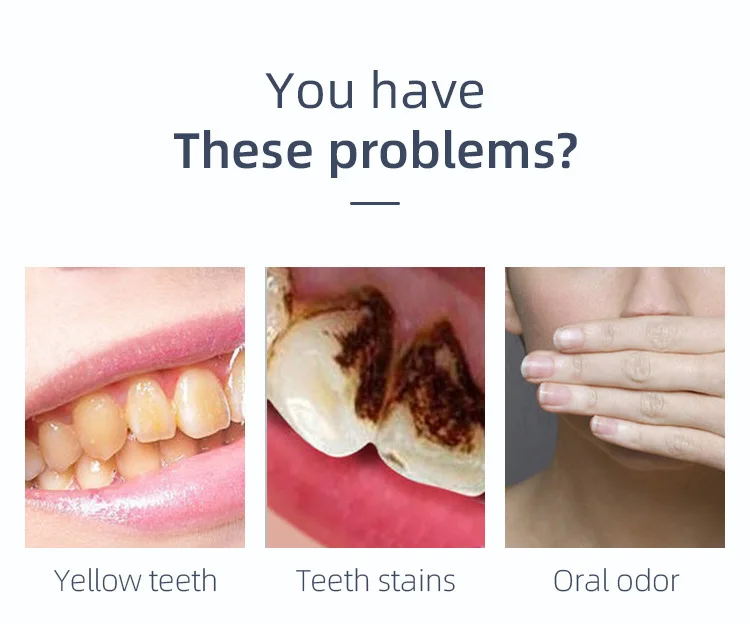 Private Label Oral Hygiene Natural Coconut Charcoal Dental ClinicTooth Powder turmeric Powder For Teeth Whitening deep cleaning