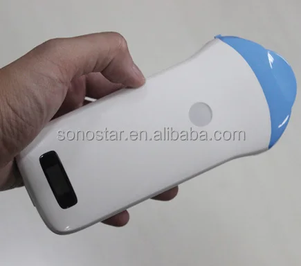 Ultrasonic, Optical, Electronic Equipment Manufacturer supply wireless probe ultrasound for mobile phone and tabletOther Ultras