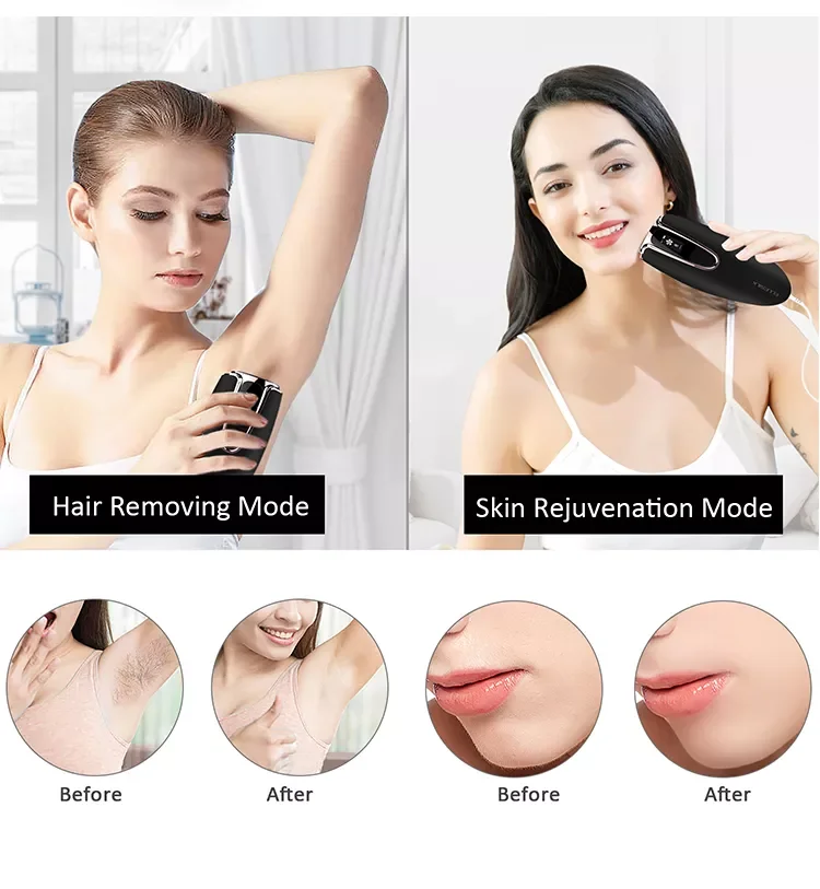 Home Use Hand Held Mini Ipl Laser Permanent Hair Removal Device Portable Laser Hair Removal