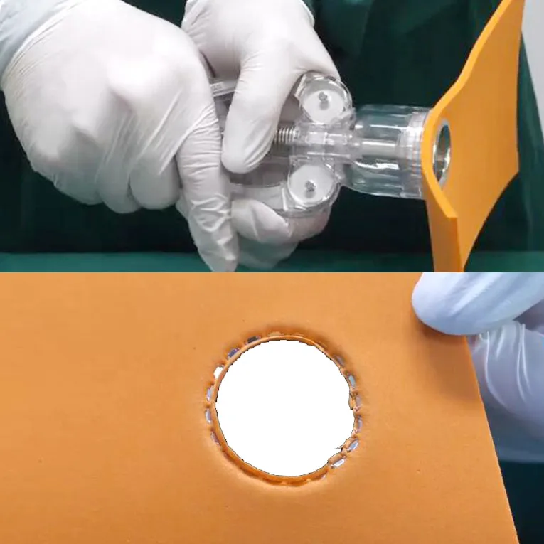 Factory wholesale QIANJING Disposable circumcision instruments for Children or Adult Male with stainless steel