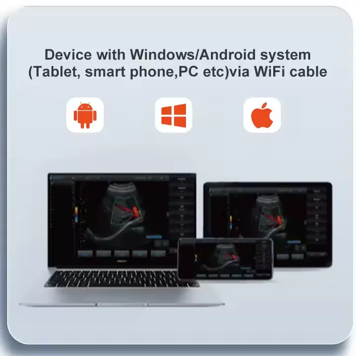 Yongyue Portable Veterinary B ultrasound Scanner Wireless Small Pet Animal Cat Dog Ultrasound Machine