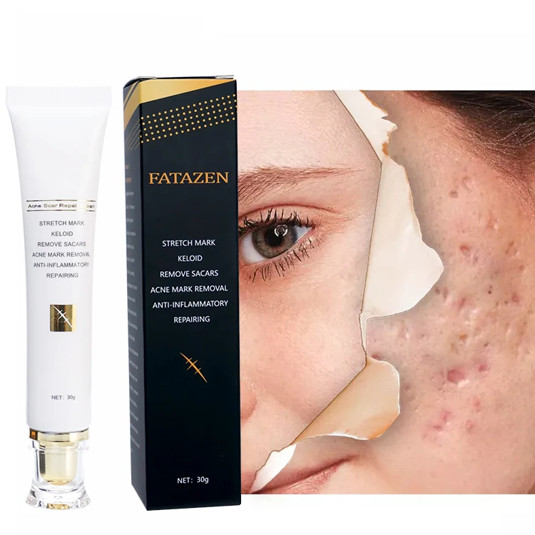 Private Label Herbal Effective Skin Repairing Gel Natural Acne Pimple Mark Stretch Marks  Remove Face Gel  Scar Removing Cream