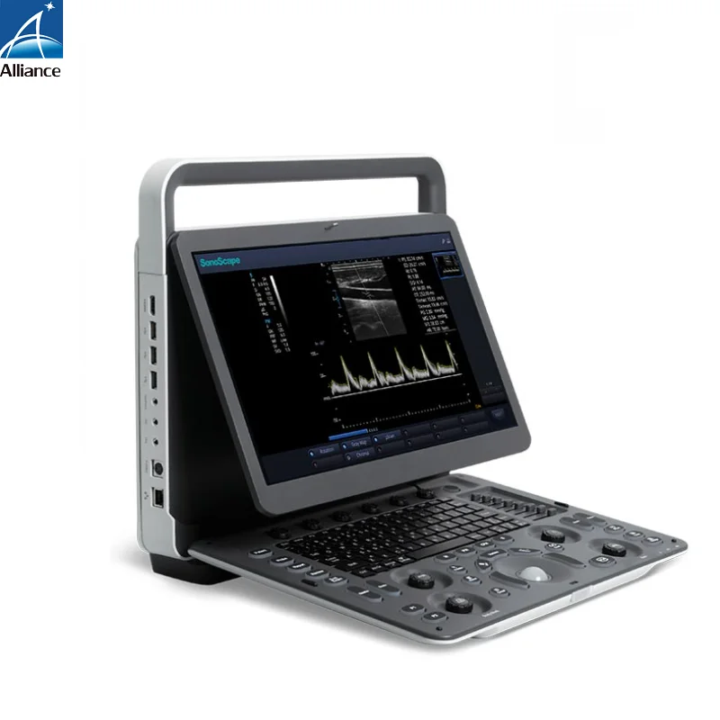Портативный черно-белый ультразвуковой аппарат Sonoscape 2D E1, экран 15,6 дюйма, жесткий диск 500 ГБ, Wi-Fi доступен