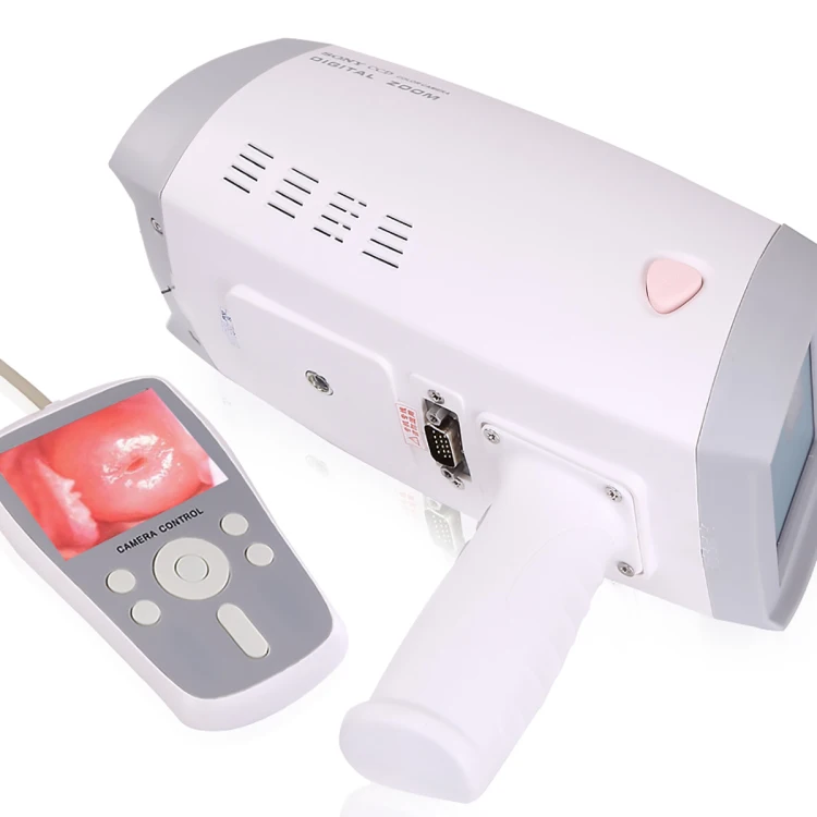 Portable digital video colposcope for gynecological clinical diagnostic equipment