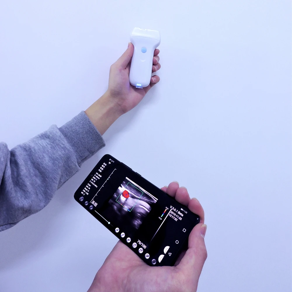  Портативный ультразвуковой допплер USB и Wi-Fi зонд
