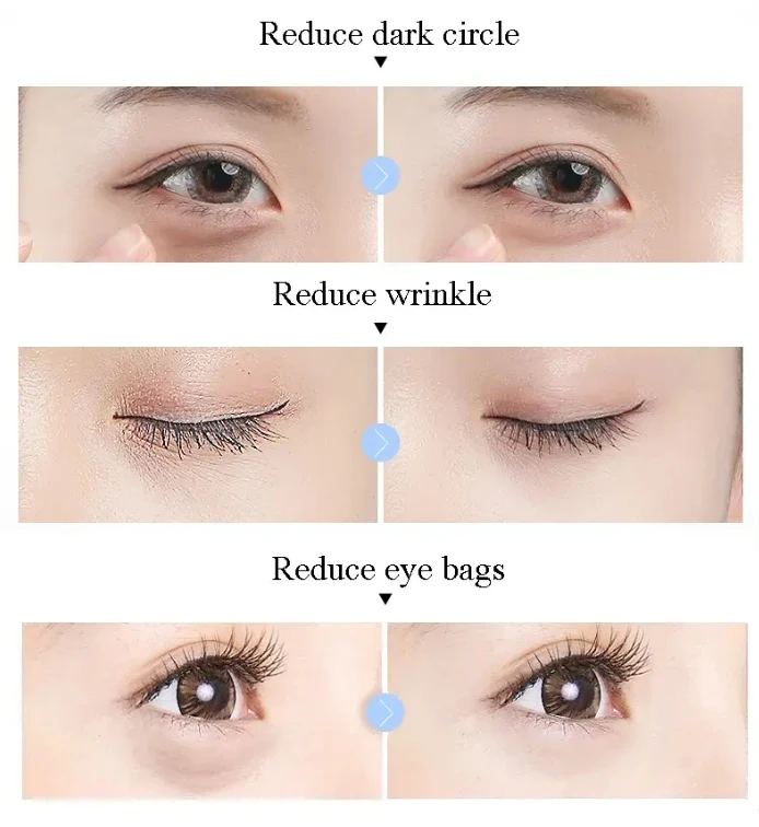 Private Label Rolanjona Anti-wrinkle Eye Cream Hyaluronic Acid Peptides Eye Repair Cream Electric Vibrate Eye Cream Moisturizer