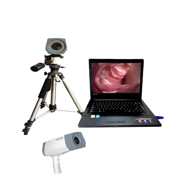 China factory Vaginoscope price Vaginoscope software for Medical equipment OEM service