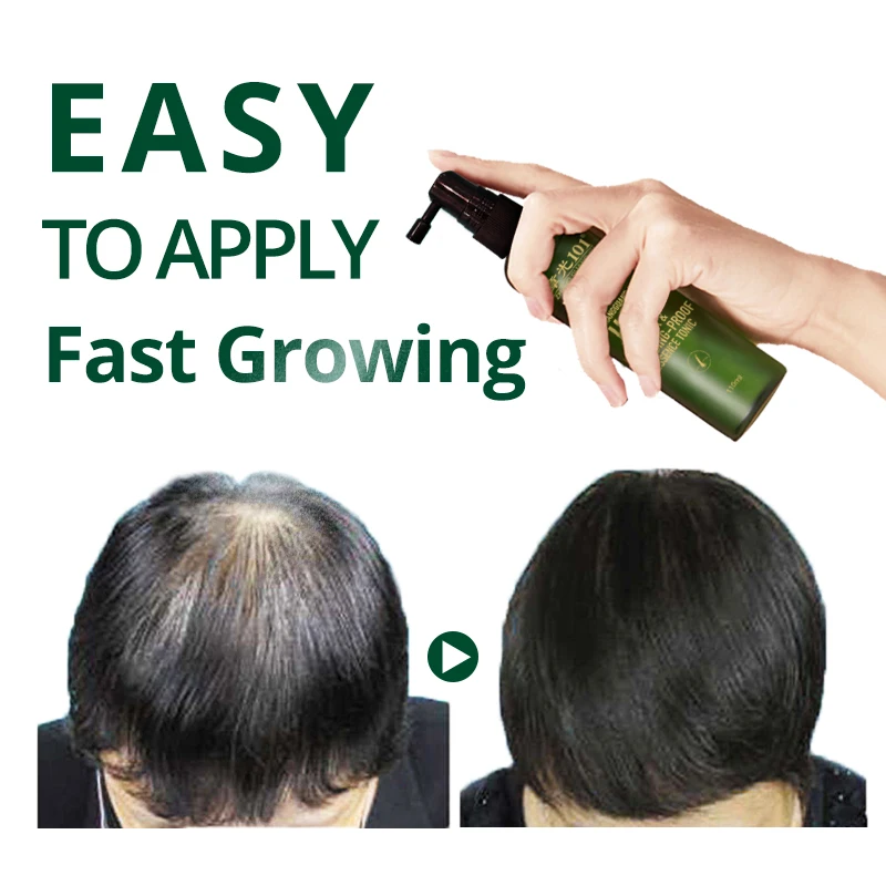 Private Label Castor Oil Extracts Hair Care Hair Growth Serum Spray