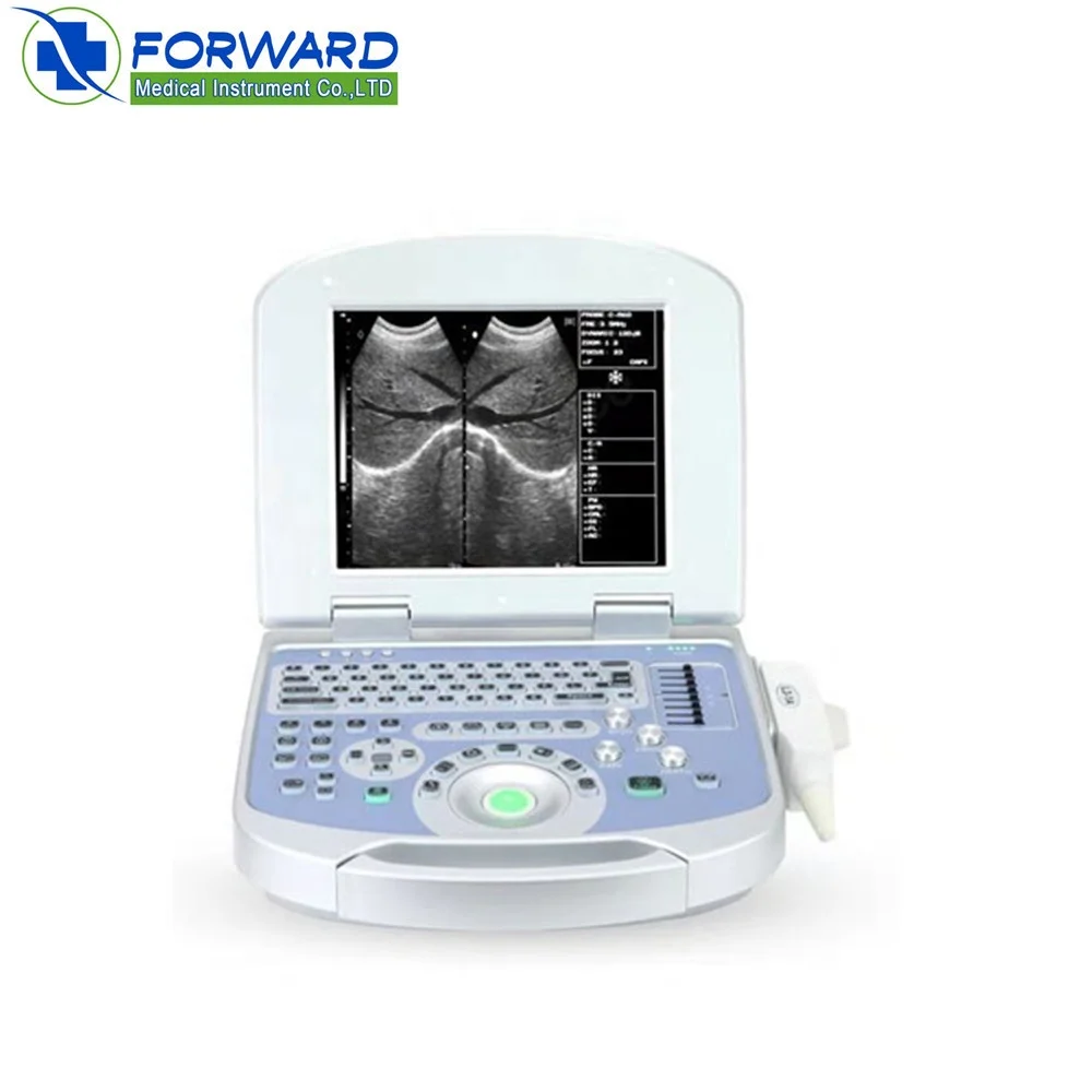 Medical Echography Portable Ultrasound Machine 3D 4D