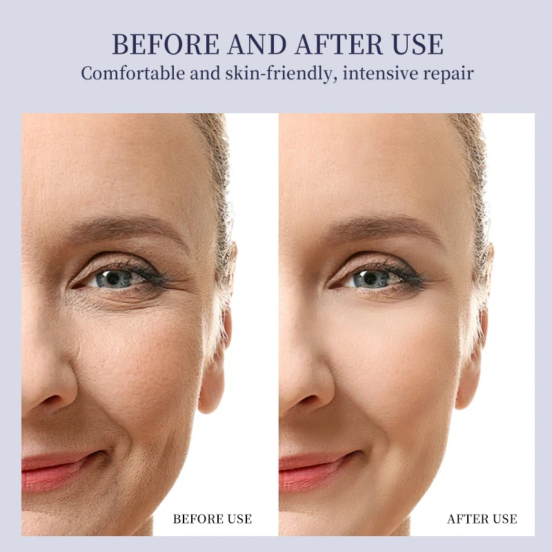 OEM Factory Price Wholesale Squalane Pure Women Anti Wrinkle Essence Natural Organic Oil Aging Pore Shrinking