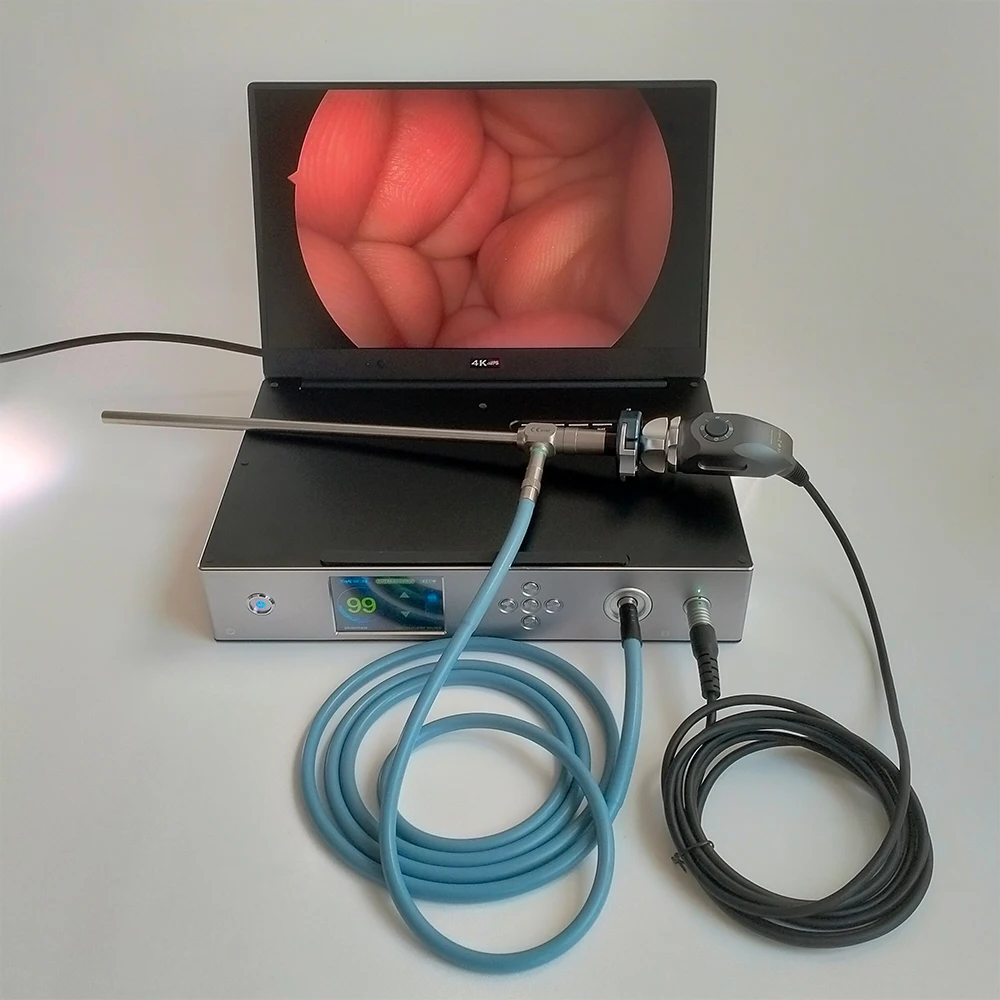 Medical portable Rigid Endoscope Sinuscope camera otoscope laryngoscope USB 3.0 Full HD 1920x1080P laparoscopic camera