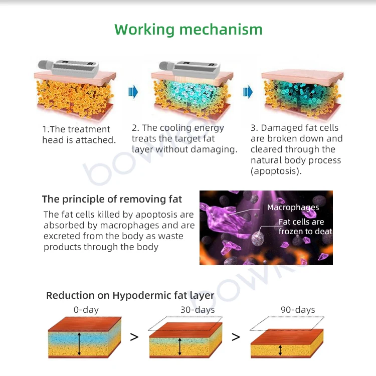 Chin remove Waist Reduction hot massage Body Sculpting System cryo facial machine