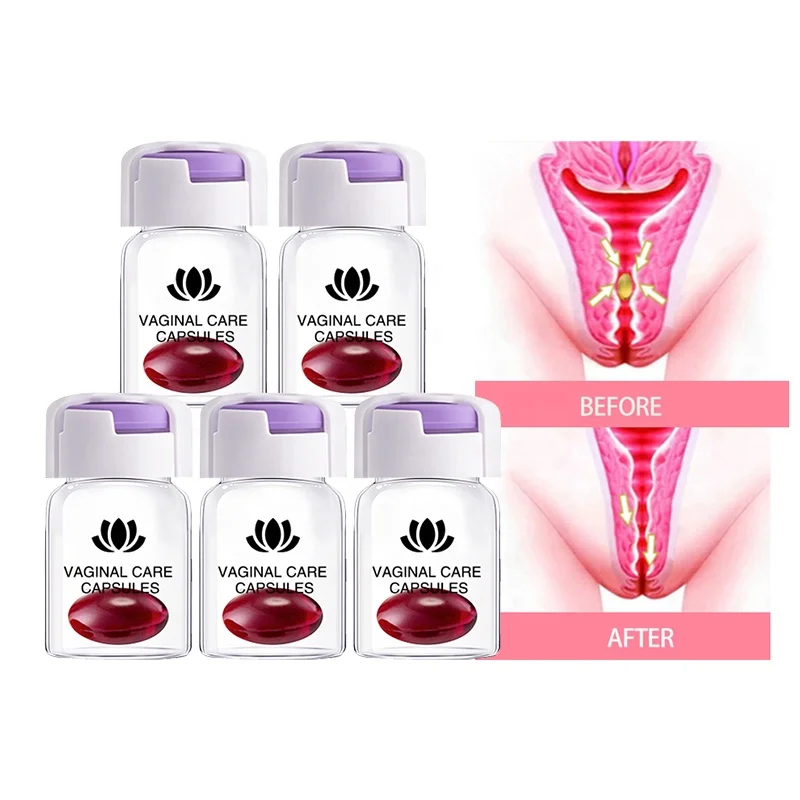 Customize Logo Remove Odor Detox Feminine Care Relieve Restore Vaginal Tightening Elasticity Vaginal Care Capsules