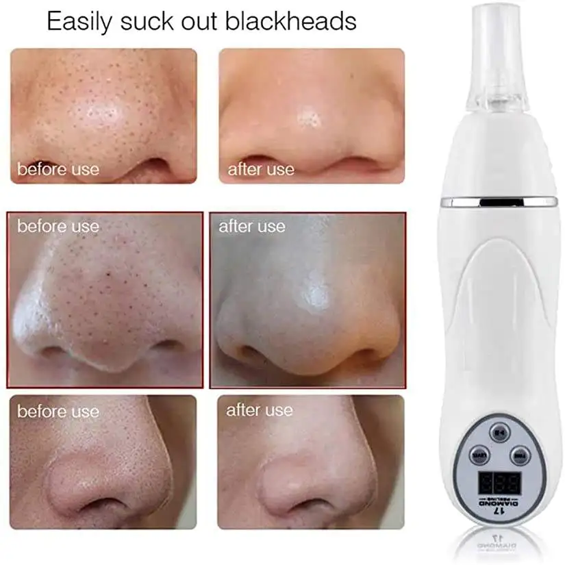 Blackhead Remover Vacuum Suction Facial Comedo Acne Remover Nose And Face Vacuum Pore Cleaner Blackhead Remover