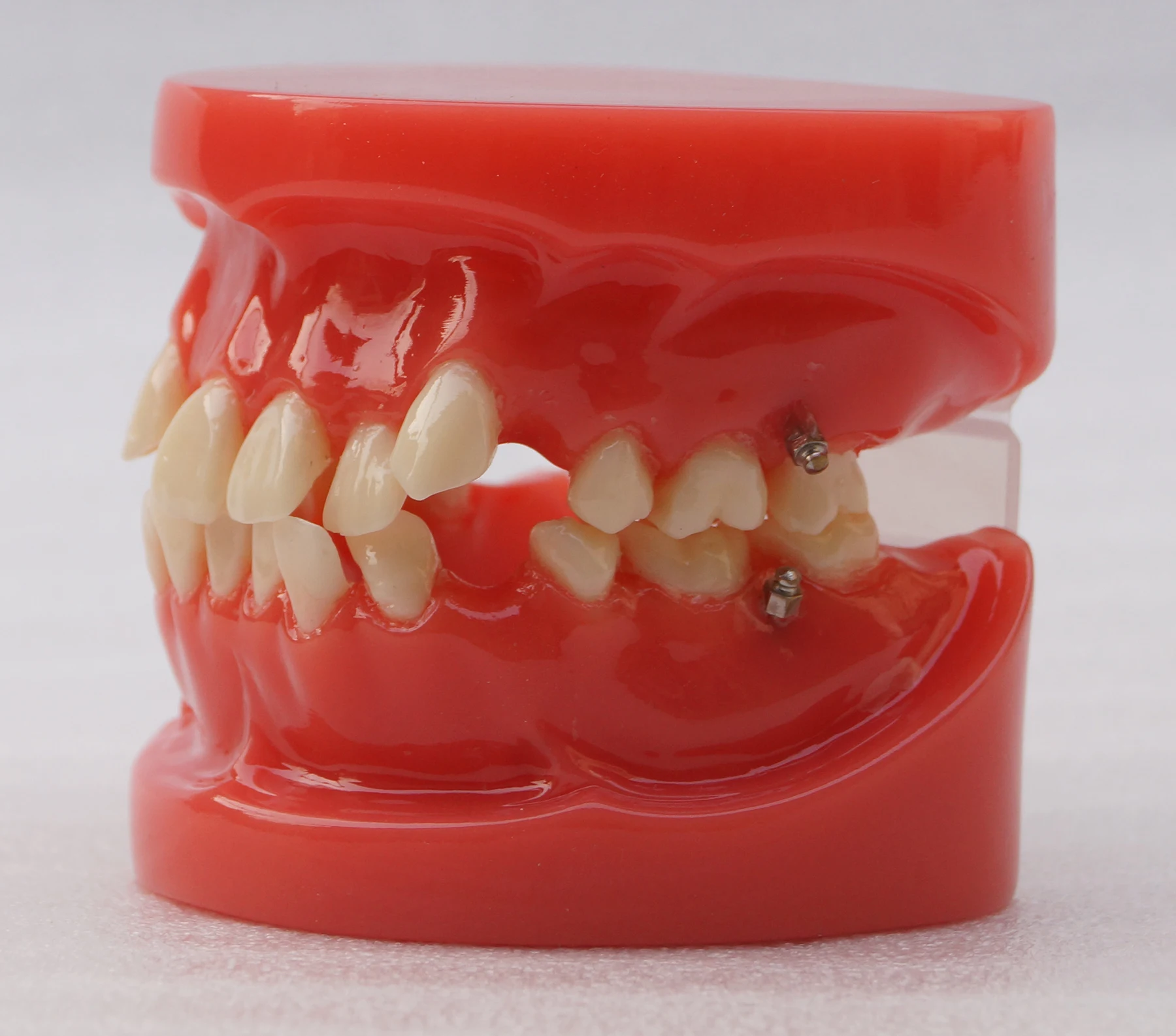 Dental Orthodontic Model 24Teeth Study Model