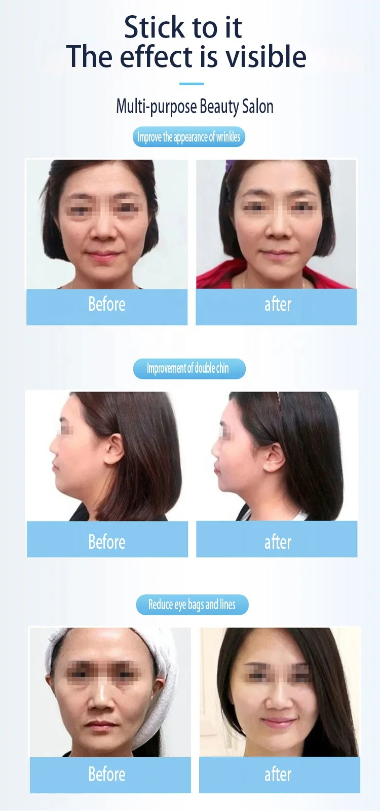 Skin Management Device Face CleaningMachine Accessories Hydro Diamond Machine German Crystal Microdermabrasion Machine