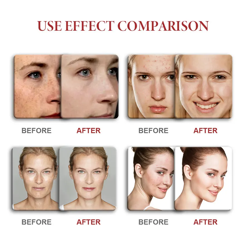 BTJ Kojic acid soap  Brightening and whitening kojic acid soap Fade black spots Acne removal Facial and body soap H1