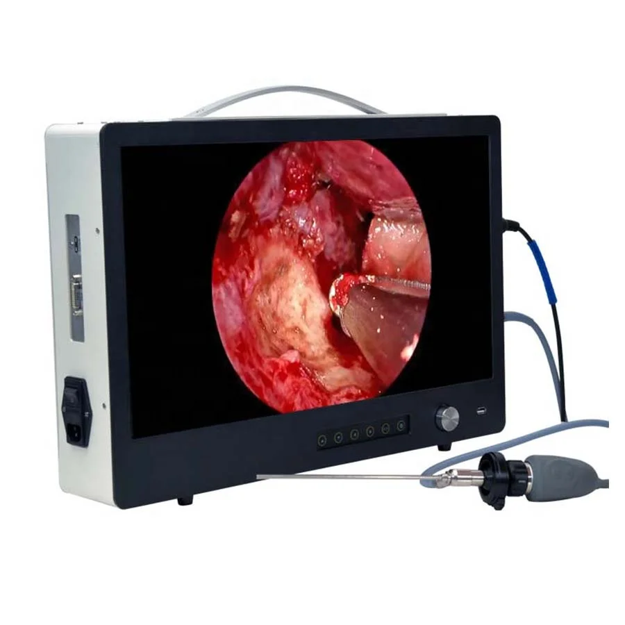 Endoscopic equipment portable Full HD Endoscope Camera u007F 1080P HD Camera  HDMI Video Output Portable Full HD Endoscope Camera