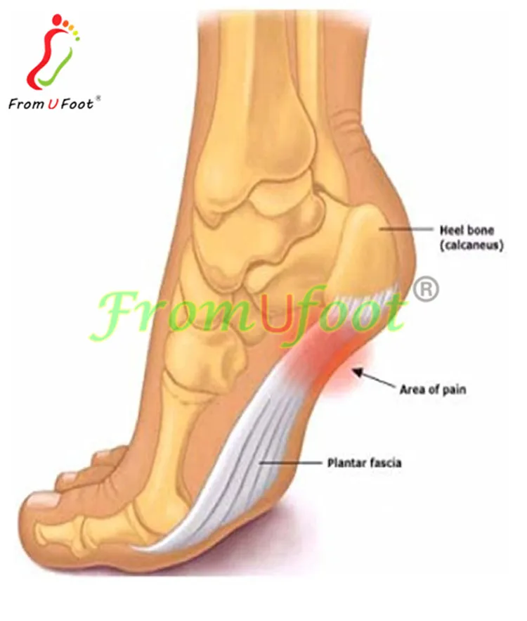 Hot selling amazon adjustable arch support brace plantar fasciitis strap with gel