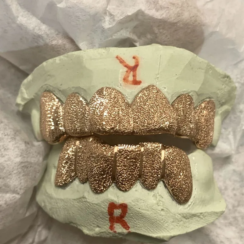 18K Gold Plated Moissanite Teeth Grillz Invisible 100% Pass The Diamond Test 925 Silver VVS Custom Hip Hop Iced Out Grillz
