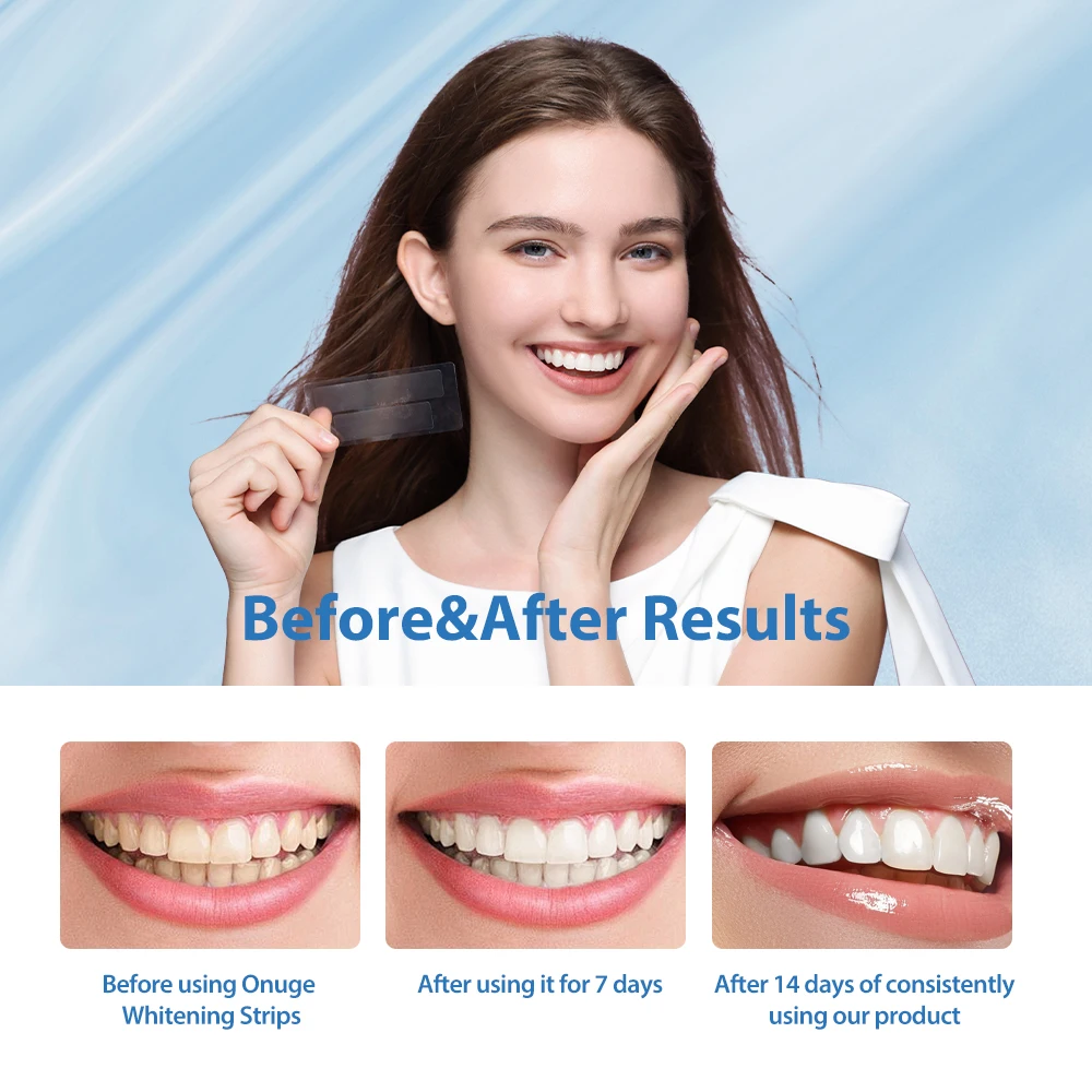 Onuge Verified Pro carefully selected charcoal organic teeth whitening strips for wholesale
