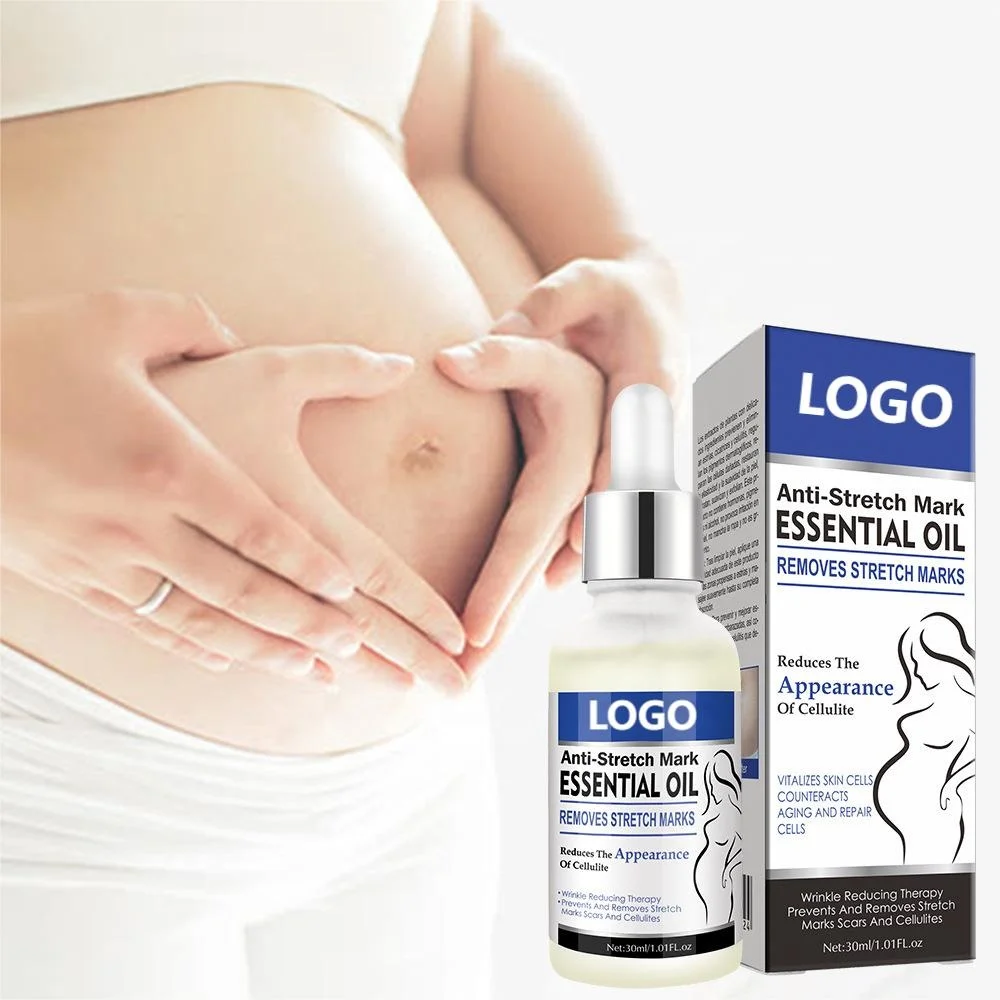 Private Label Anti Stretch Marks Massage Repairing Best Effective Body Oil For Stretch Marks Skin Care Essential Oil