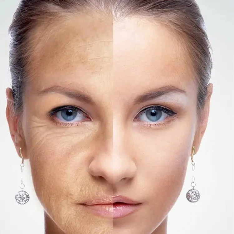 Food Grade Sodium Hyaluronate Powder Hyaluronic Acid Price