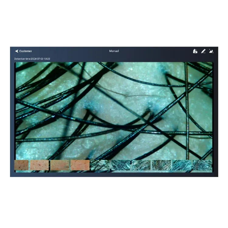 MEICET MFJC-1B Digital Scalp & Body Hair Analyzer Machine Wi-Fi Wireless Camera Detector for US EU JP IT ZA Plugs