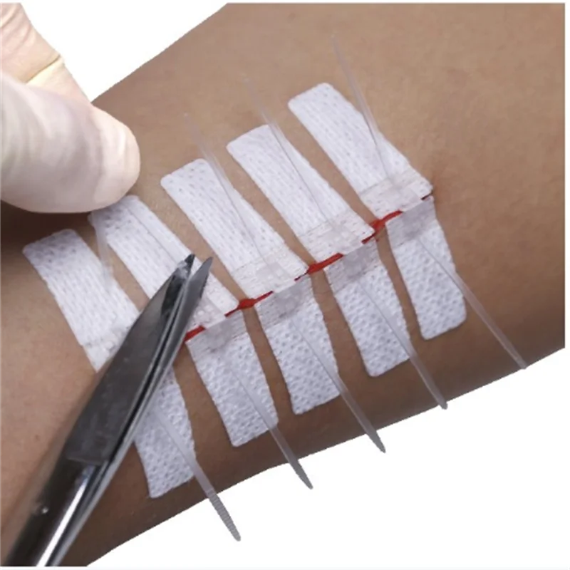 Medical Grade Adhesive Wound Skin Closure Device Non Woven Wound Closure Device