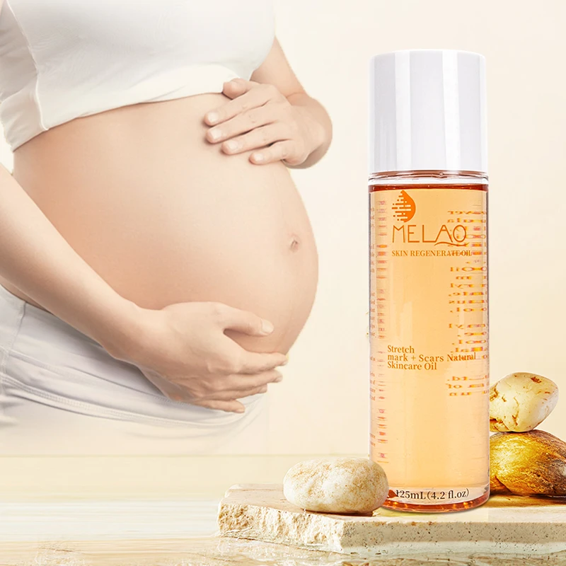 OEM/ODM MELAO Wholesale Stretch Mark Oil Natural Organic Skincare Regenerate Oil Scar Repair Stretch Mark Removal Body Oil
