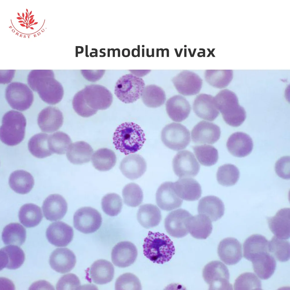 Microscope Slides 10Pcs Protozoa And Algae Slides Set Medical Science Microbiology Education Specimen Prepared Microscope Slides