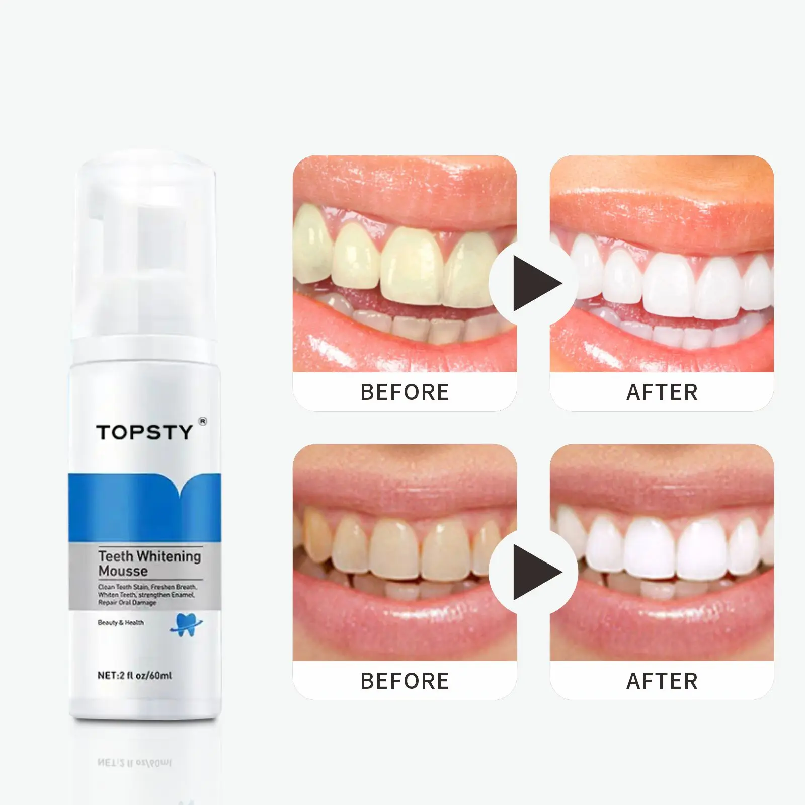 Teeth Whitening, Tooth Stain Removal, Color Corrector Serum, Teeth Whitening Booster, Whitening Tooth Foam
