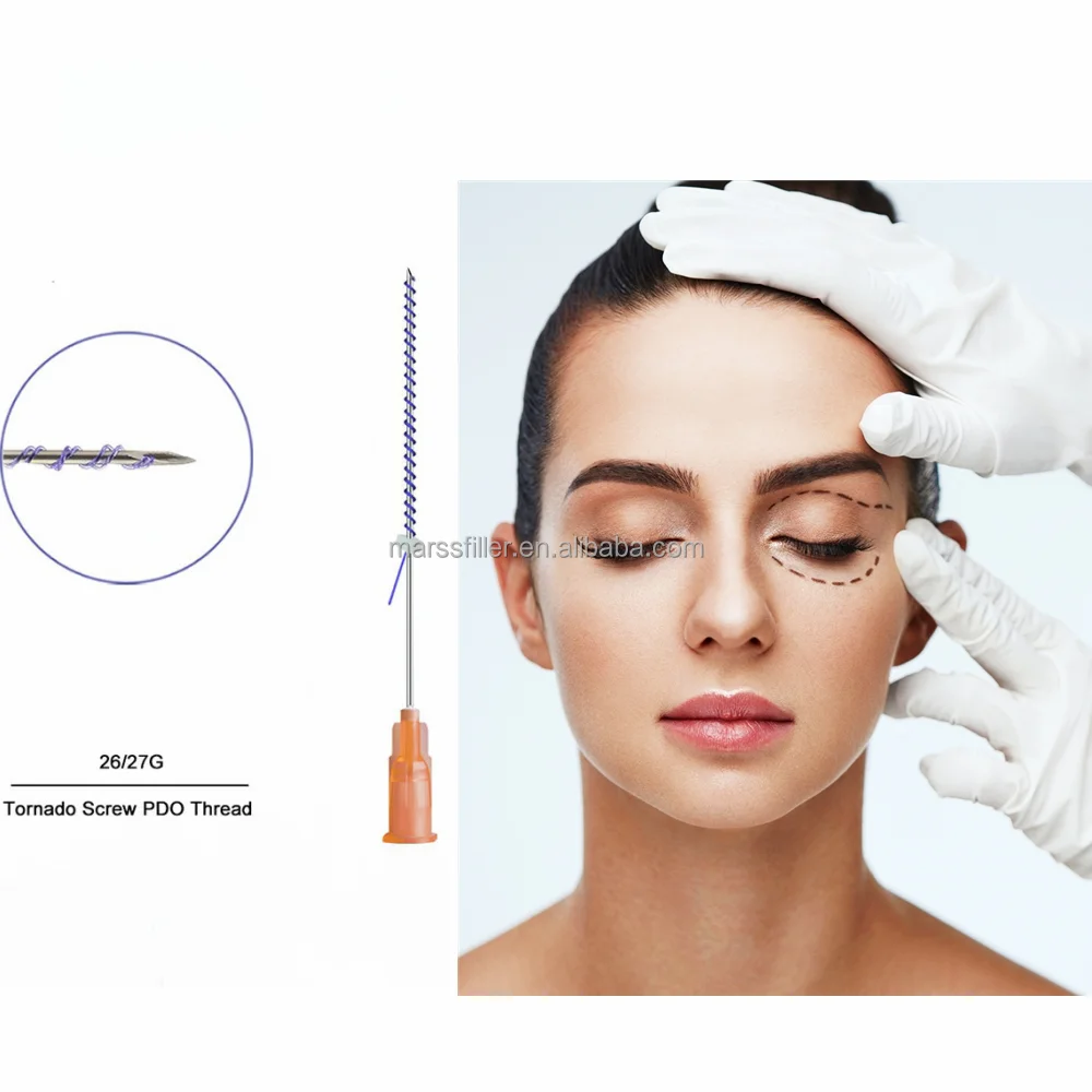 27G 38mm Pdo Facial Tornado Screw Thread korea Face Lifting PDO Threads for Tightening Suture Deep Wrinkles pdo Threads to buy