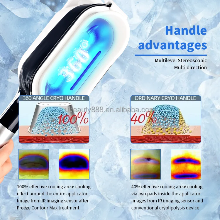 New Design Fat Freeze 360 Cryo Slimming Machine Fat Free Cryo Machine