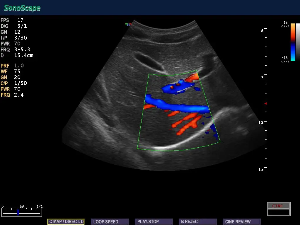 Sonoscape S6 Portable 4D Color Doppler Ultrasound For Human