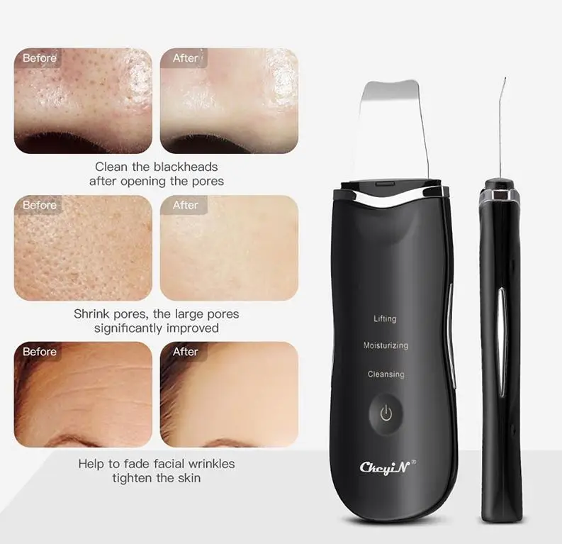 Beauty Care Exfoliating Skin Rejuvenating Instrument Ultrasonic Skin Scrubber